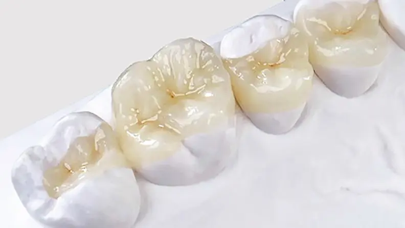 Restauração Dental